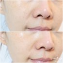 뷰티NP(뷰티엔피) | 아줄렌 버블 토너 시어스 카줄렌 수딩 토너로 민감 피부 싹 진정시킨 후기