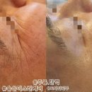 송은미스킨케어