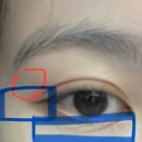 내돈주고 주기적으로 맞는 아이리쥬란 후기 아이...고르는 꿀팁 다 담음/ 눈밑 콜라겐주사 비추 이유