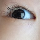 양산밝은안과의원 이미지