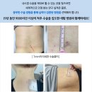 나아짐 이미지