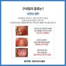 42좋은치과의원 네이버블로그