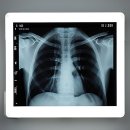 이룬의원 | 치아 이슈는 이제 안녕! 찐 솔직 후기 들고 왔어요