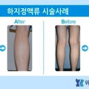 위대항맥외과의원 네이버블로그