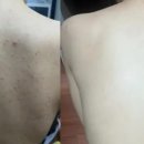 더마솔루션 이미지