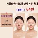 링클스탑의원 이미지