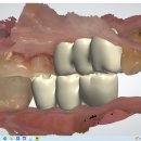 장치과기공소 이미지
