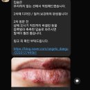 안젤로 | 대구입술문신 추천 뷰티안젤로 내돈내산 남자 후기(주차, 입술타투 칠곡입술문신)