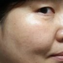 스킨케어 여우비