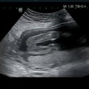행복누리산부인과