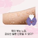 나비샘내과의원 | 갑상선 기능 항진증 병의원 내과적 진단과 체계적인 약물 관리