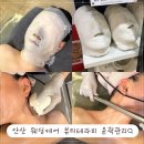 안산 상록구 웨딩케어 뷰티라이프 윤곽관리 비대칭 관리 후기