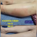 다형