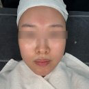 둔산중로-19 | [대전 탄방동] 피부관리 뷰티인사이드에서 바이오리필 받은 후기