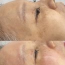 하베레피부전문센터