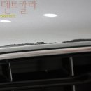 세계덴트칼라시스템