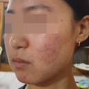 옛날한의원 | 리유한의원 가격 비용 신사점에서 치료 받은 사람이 공유합니다.