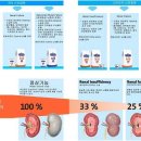 * 급성 신부전 치료 이미지