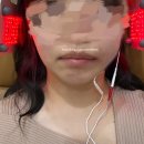 우람빌딩 | 매복 사랑니 발치 당일 - 일주일 경과 후기