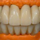 RPD치과기공소 이미지