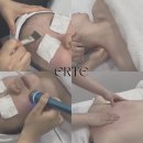 양원역로10길 | 양원역 에르떼 에스테틱 LDM, 라라필, 등관리 후기 | 중랑구 망우동 상봉 피부관리 잘 하는 곳 추천