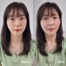 피부과 리프팅 대신 울트라 올라 홈케어 디바이스로 10분만에 라인 완성