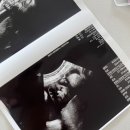 원효유치원 | [임신일기] 32주차 기록, 가진통 치골통 증상 첫째 임신중독 둘째 임신중