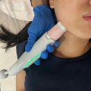 300 | [장산피부과] 센텀온다리프팅 대신 볼뉴머300샷후기 찐 내돈내산!!