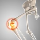 참본정형외과의원마포점 이미지