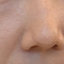 잼이슈 | 잼버실 +스컬트라 시술후기 (내돈내산)