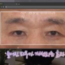 대남병원 | 우리아빠 10살 어려보이는 중년남성 눈성형의 모든 것