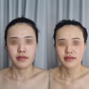 씨스페이스괴정 | 사하구괴정피부관리 스페이스뷰티 대티점 I AI측정 동안케어 얼굴관리 후기