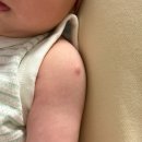 우리맘소아청소년과의원 | 수원 화서동 1차 영유아검진 BCG 피내용 접종 우리맘소아청소년과의원