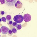 비만세포(mast cell) 이미지