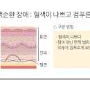 얼굴이 붓는 이유와 부종 제거 방법 이미지