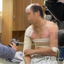 선배 몸에 끓는 물 끼얹고, 토치로 지지고… 20대 잔혹 커플 구속 이미지