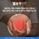 류마척제통내과 이미지