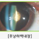 늘푸른임안과의원 이미지