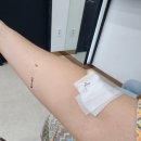 광주 담낭 제거 수술 후기 #담대한외과