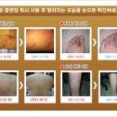 [전국 한의원에서 아토피/피부염 치료보조제로 처방하는 미네랄 한방 클렌징 워시] 이미지