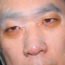 아토러브,모델링팩,마스크시트팩,아토피 여드름피부 편백나무의 효능으로