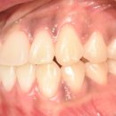 U 치과기공소 이미지