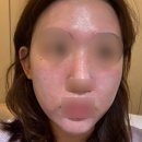 씨유 천안불당라드니체점 | 천안피부관리 잘하는 곳 불당 피부관리 전문샵 &#39;퓨어르떼&#39; 해초필링 케어 후기
