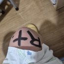 책 읽고 꼼지락 꼼지락 | 전거비 인대 파열 수술 후기