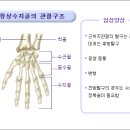 수지골절 탈구 이미지