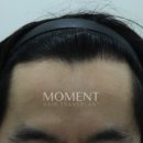 모먼트의원 이미지