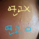 여름오기전 피부관리 내돈내산 잡티제거 편평사마귀 제거후기