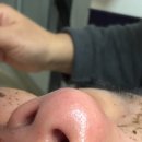 (유)태평양 | [상동 여드름관리] 문제성피부관리 잘하는곳 찾는다면 ”뷰티포톤피아“ 바이오필 후기