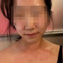 목은빌딩 | 편평사마귀 거우침으로 조진 후기 (결론 : ㄱ만족)