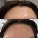 카다리나헤어라인 | 인천 남동구 간석동 미꼼 왁싱 헤어라인 받고 웨딩촬영 후기